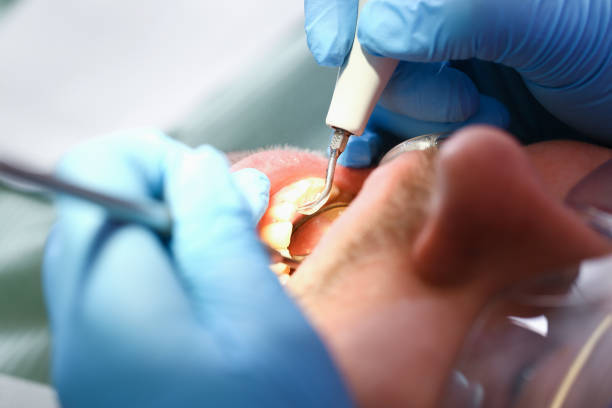 Best Pediatric Emergency Dentist in Nashua, NH