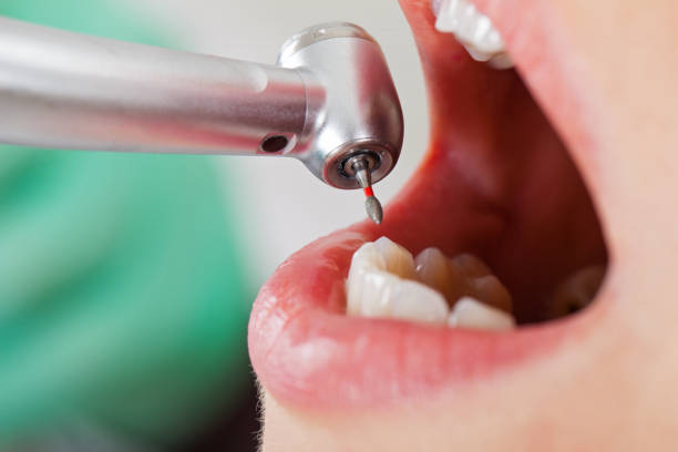 Best Emergency Cosmetic Dentistry in Nashua, NH